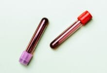 Blood Test for Survival Prediction