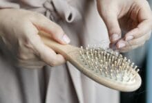 Weight Loss Drugs Linked to Hair Loss